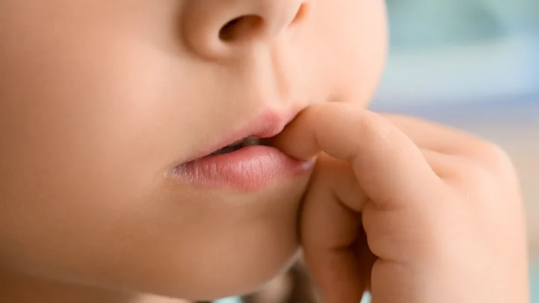 Çocuklarda Tırnak Yeme Alışkanlığı